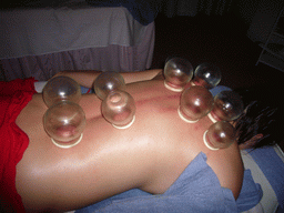 Miaomiao having a Chinese cupping massage at a massage salon in the city center