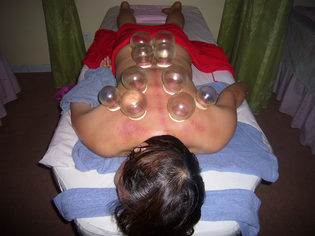 Miaomiao having a Chinese cupping massage at a massage salon in the city center