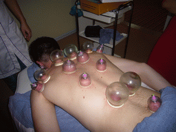 Tim having a Chinese cupping massage at a massage salon in the city center