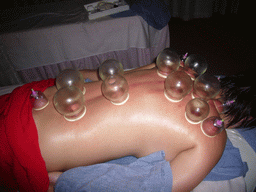 Miaomiao having a Chinese cupping massage at a massage salon in the city center