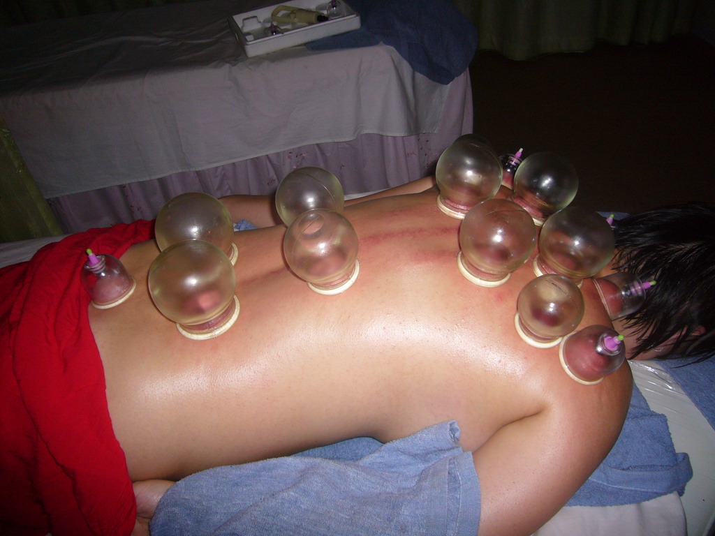 Miaomiao having a Chinese cupping massage at a massage salon in the city center