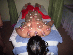 Miaomiao having a Chinese cupping massage at a massage salon in the city center