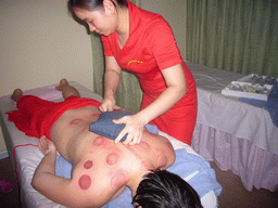Miaomiao right after a Chinese cupping massage at a massage salon in the city center