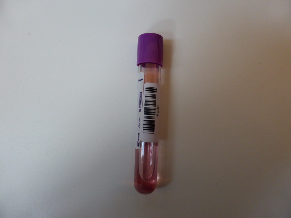 Biosample tube at the HandsOn: Biobanks 2013 conference at the World Forum conference center